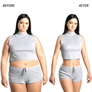 weight-loss-treatment